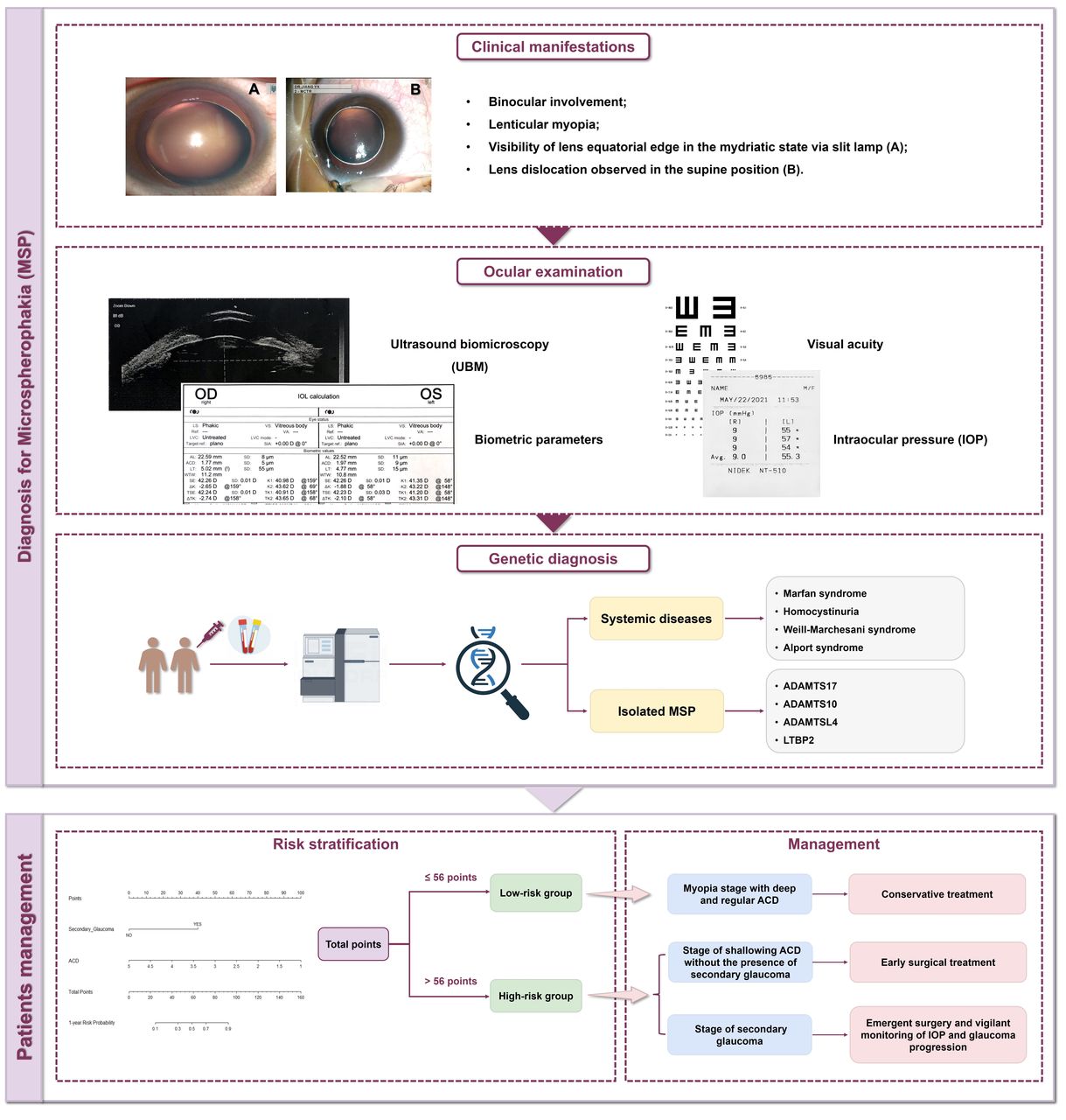 Novel classification for microspherophakia and its related