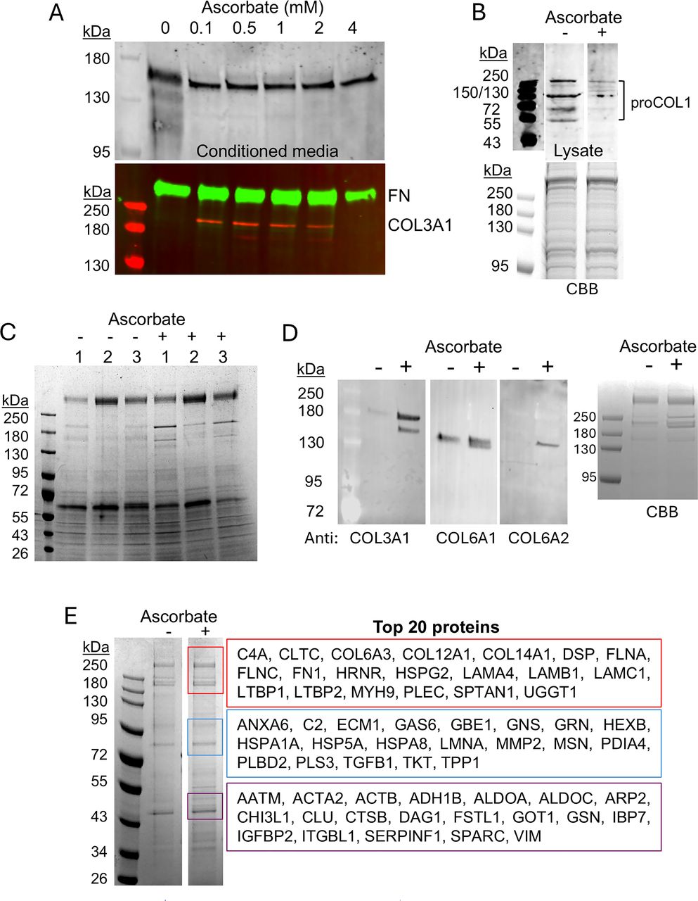 Effects of ascorbic acid on trabecular meshwork gene expression and ...